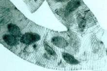 Akarapidoza - zakażenie swidraczkiem pszczelim